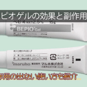 ベピオゲル(過酸化ベンゾイル)の効果と副作用！市販で買える？オンライン通販で安いのは？