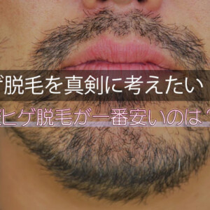 ヒゲ脱毛が安いおすすめクリニック！メンズ髭脱毛の値段を比較【東京・横浜・大阪】