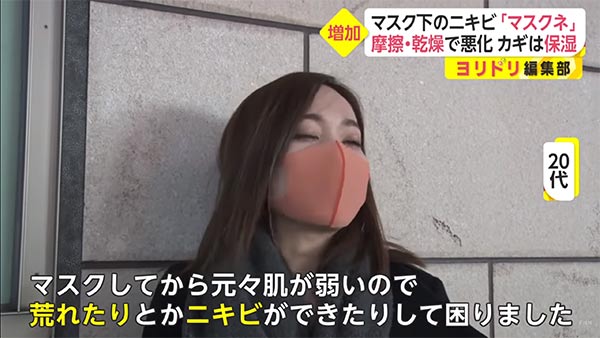 マスクネ予防のヒント