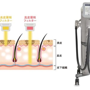 ステラM22の値段が安いおすすめクリニック2選！最新のステラM22の効果が凄い！