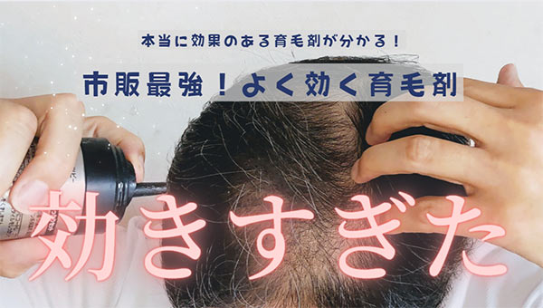 よく効く育毛剤ランキング！おすすめは？本当に効果のある市販最強の育毛剤は？